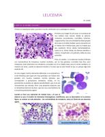 64.-Leucemia-en-pediatría.pdf